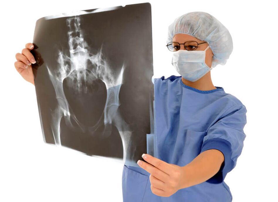 Las radiografías de cadera ayudarán a los médicos a determinar la causa del dolor. 