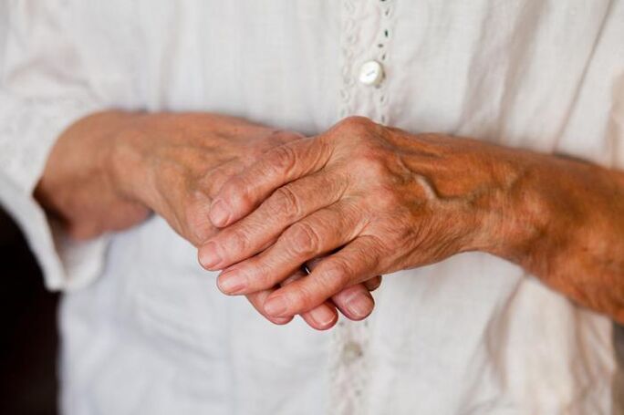 El dolor en las articulaciones de la mano afecta a menudo a las personas mayores