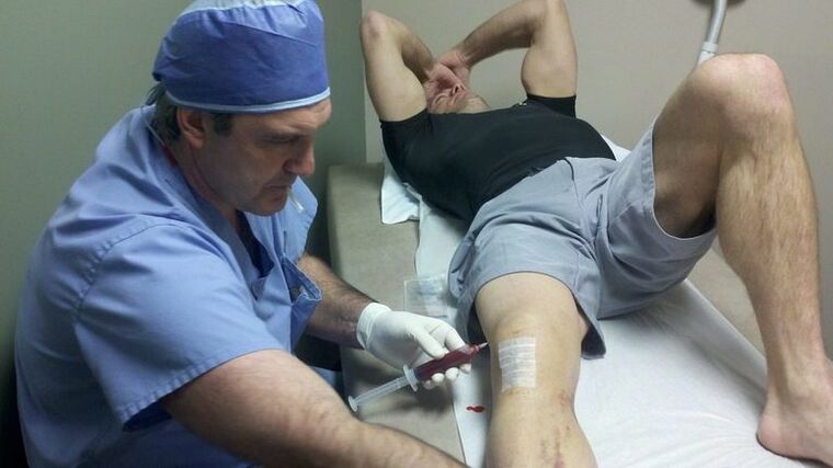 Trate las articulaciones de las articulaciones de la rodilla
