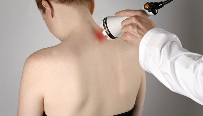 Tratamiento con láser para la osteocondrosis cervical.
